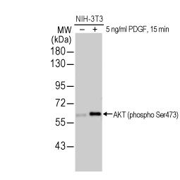 AKT (phospho Ser473) antibody (GTX128414) AKT (phospho Ser473) antibody (GTX128414)